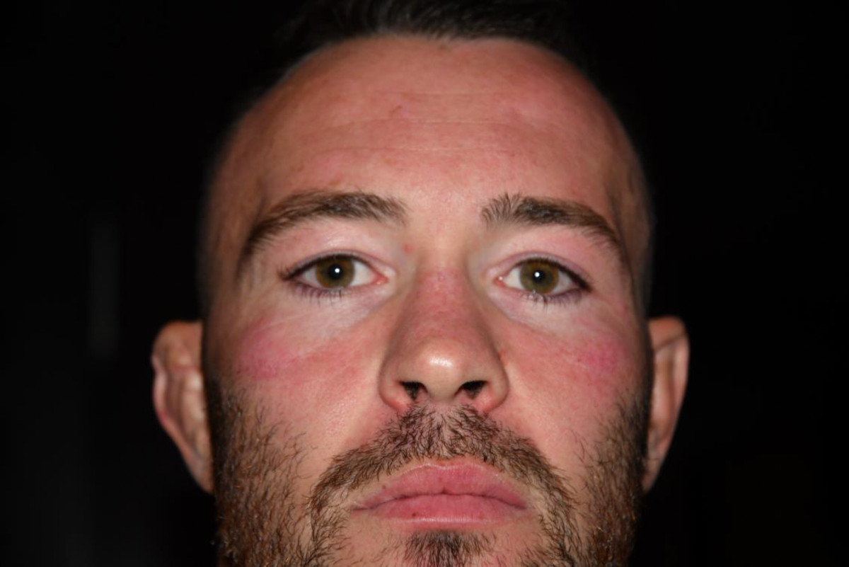 Photos of Colby Covington after the alleged assault of Jorge Masvidal. 